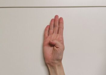 Stalking, picchiata dall’ex fa il “gesto d’aiuto”: i passanti se ne accorgono e fanno arrestare l’uomo