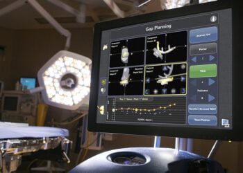 Ecco Navio, un robot per protesi al ginocchio precise al millimetro: prima volta in Puglia a Conversano