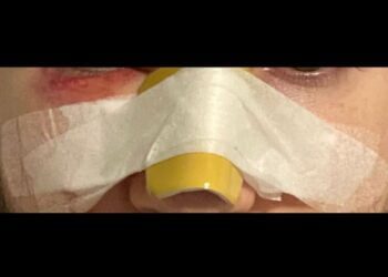 “Ti spacco la faccia”, picchiato a sangue mentre è in coda per un panino. Pestaggio al McDrive