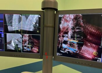 Computer Assisted Spine Surgery (2)