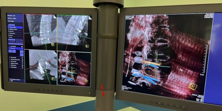 Computer Assisted Spine Surgery (2)