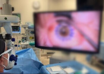 Trapianto Di Cornea Oculistica Putignano (2)