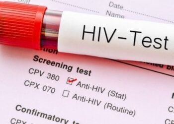 Test Hiv