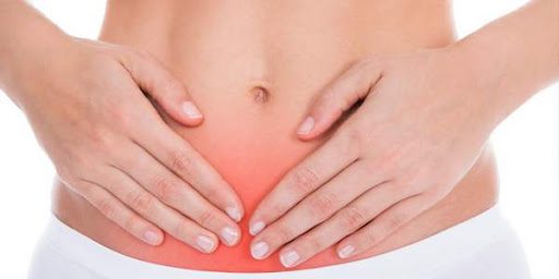 Endometriosi