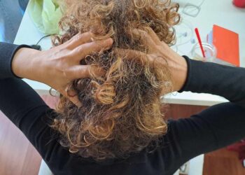 Mal Di Testa Testa Capelli
