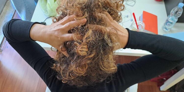 Mal Di Testa Testa Capelli