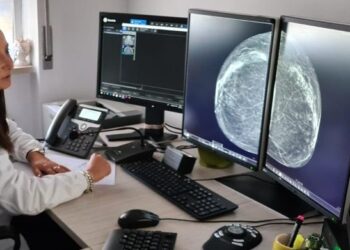 Screening Mammografico