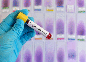 Legionella 1
