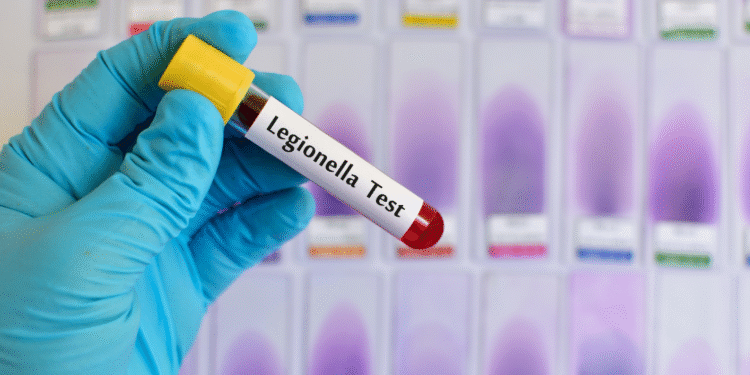 Legionella 1