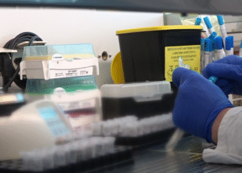 Test Sanitari Epatite Hiv