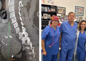 gozzo tiroide policlinico