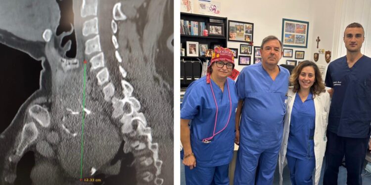 gozzo tiroide policlinico