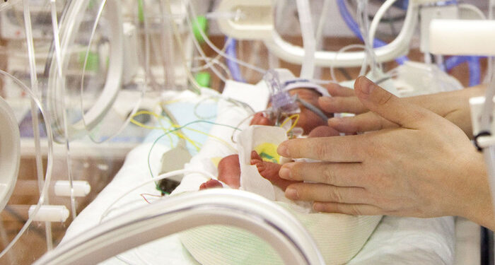 neonato prematuro