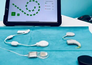 Impianto Cocleare Smart
