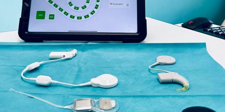 Impianto Cocleare Smart