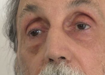 Premio “tommaso Francavilla”, Vince Telebari Con La Storia Di Lorenzo: L’ex Clochard Diventato Poeta – Video