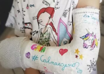 Gesso Bambino Ospedale