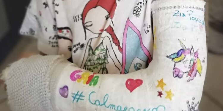 Gesso Bambino Ospedale