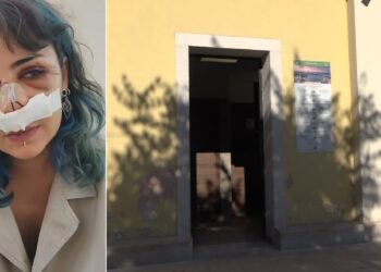 Giuditta Aggressione Parco Rossani