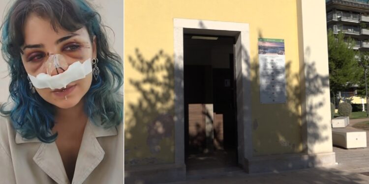 Giuditta Aggressione Parco Rossani