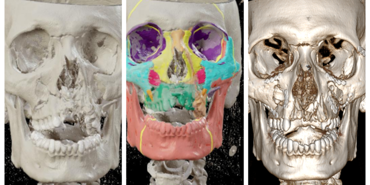 Immagini Fasi Pre E Post Operatoria Intervento