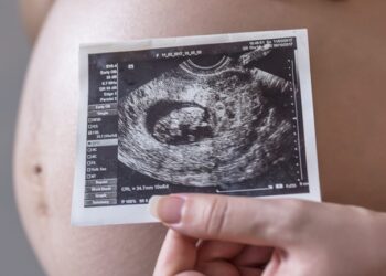 Pregnant Woman Holding Photo Of Her Future Baby
