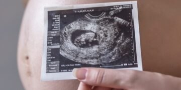 Pregnant Woman Holding Photo Of Her Future Baby