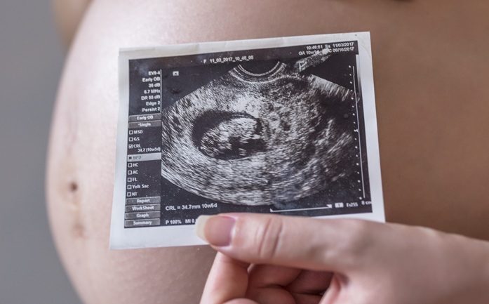 Pregnant Woman Holding Photo Of Her Future Baby